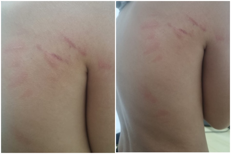 Criança com TDAH sofre agressão da própria mãe em Pirassununga